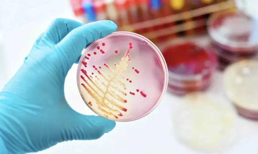 WHO requires vigilance in opposition to 4 new antibiotic resistant superbugs
